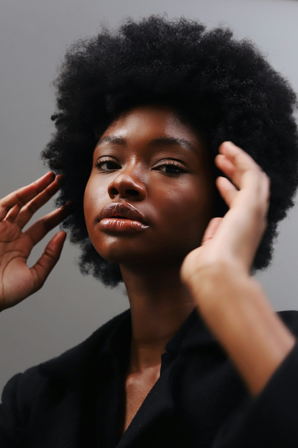 Dark Spots & Hyperpigmentation